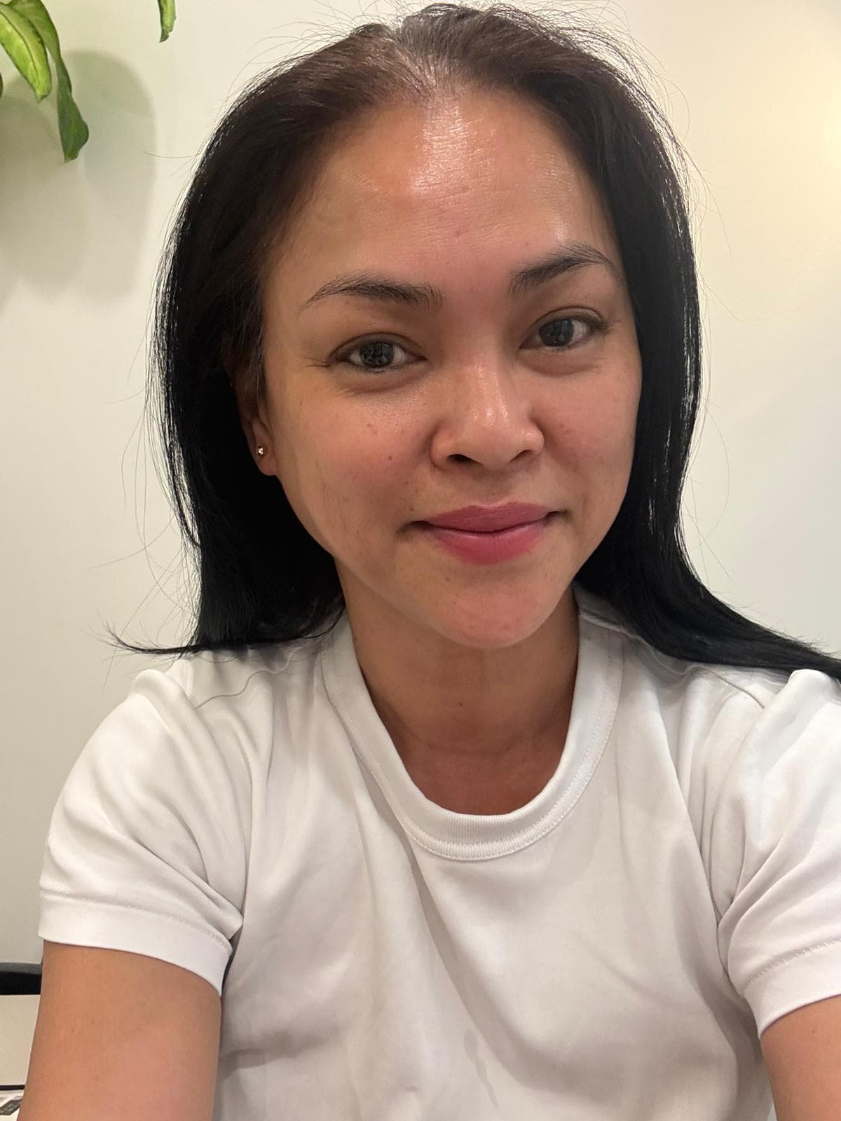 Joy, Skin and Acne Specialist at Glow Skincare